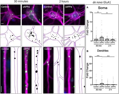 Secreted Amyloid Precursor Protein-Alpha Enhances LTP Through the Synthesis and Trafficking of Ca2+-Permeable AMPA Receptors